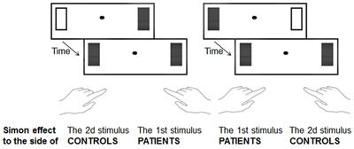 Schizophrenia And Consciousness: A Testable Hypothesis: A Testable Hypothesis
